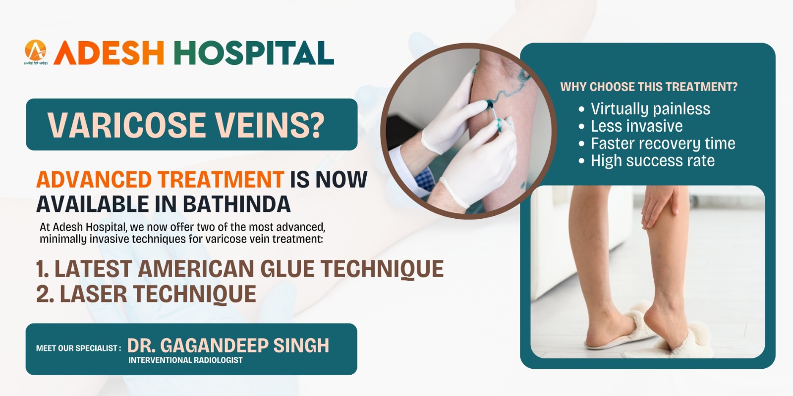 Varicose Veins? Advanced Treatment is Now Available in Bathinda